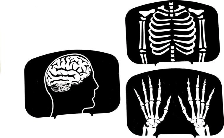 Aprendizaje divertido con radiografías